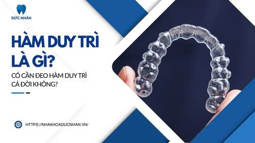 Hàm duy trì là gì? Có cần đeo hàm duy trì cả đời không?